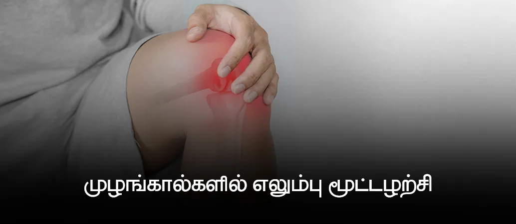 Knee Pain from Osteoarthritis