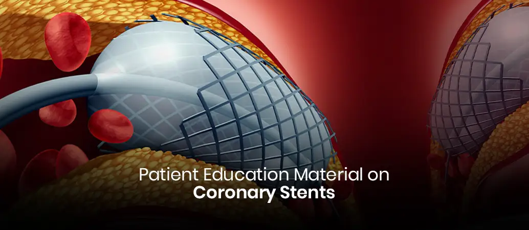 Patient Education Material On Coronary Stents