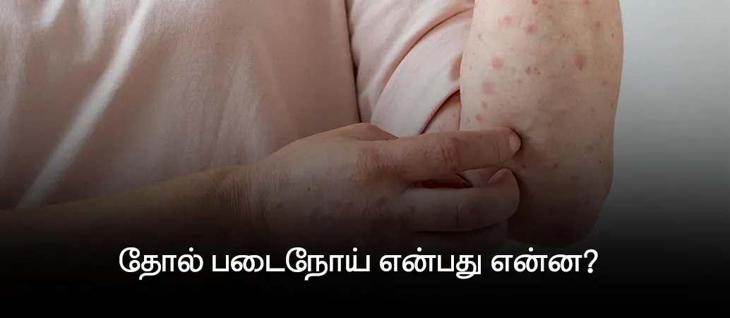 Understanding common skin diseases