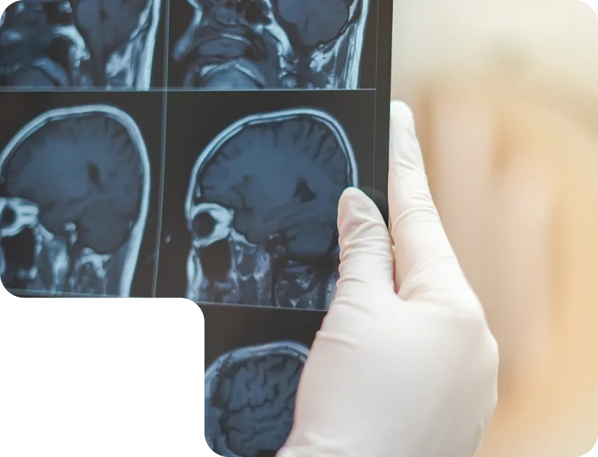 Neurosurgery