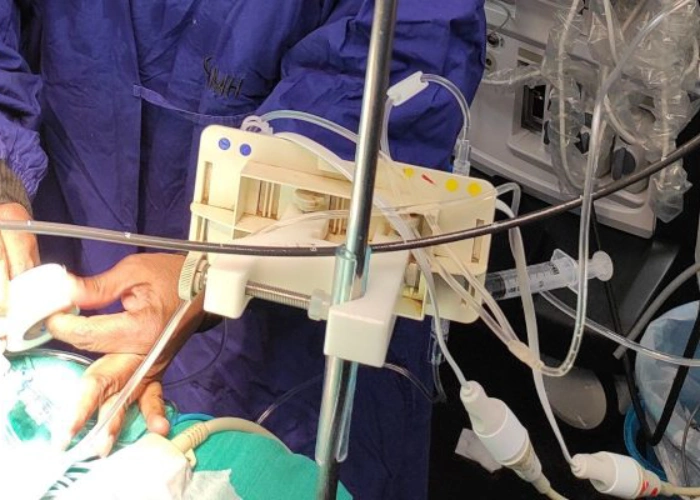 Paediatric Cardiac Anaesthesia Procedure image 2