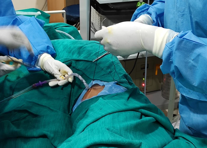 Lung Specialist In Coimbatore image 8