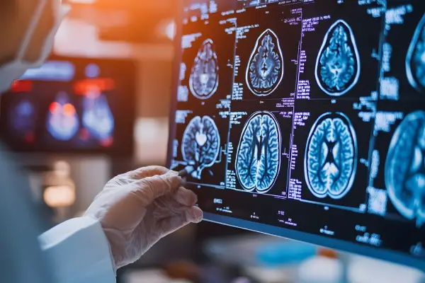 Best Neurosurgeon In Coimbatore
