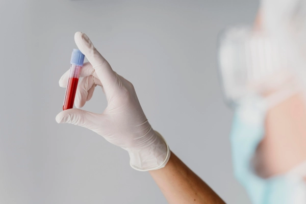 Division Of Transfusion Medicine And Blood Banking Related Specialities