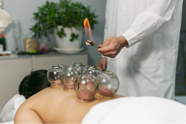 Cupping Therapy