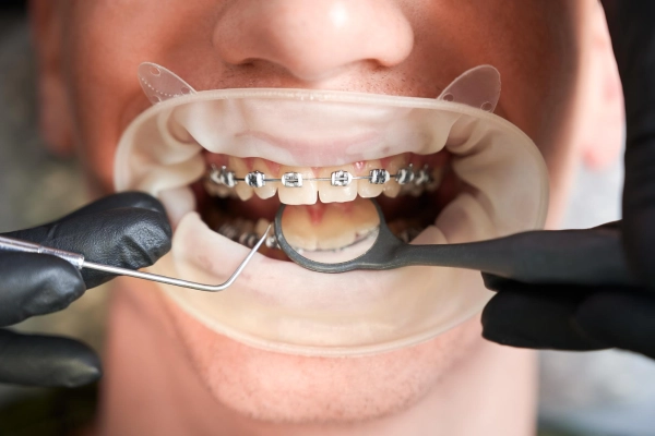 Orthodontics