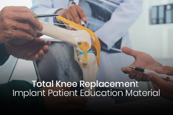 Patient Guide on Total Knee Replacement Implant
