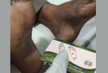 10g monofilament foot test