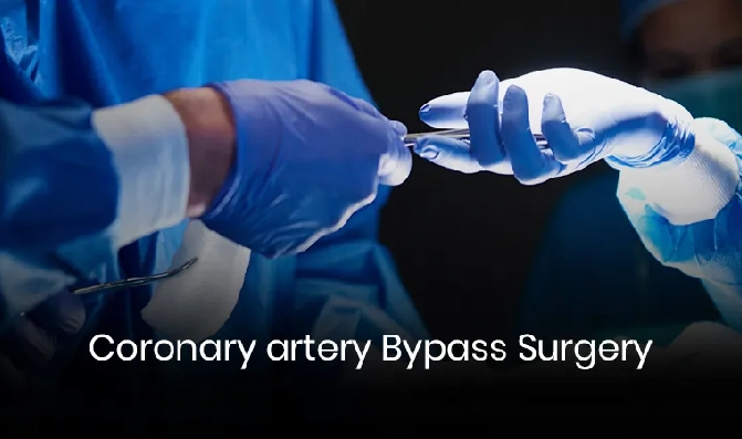 Coronary artery bypass surgery