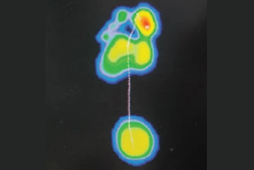 Podia scan foot test