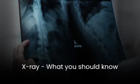 X-Ray What you should know